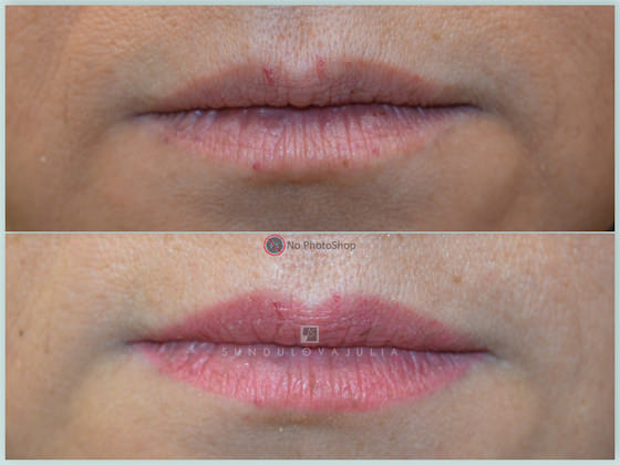 Permanent makeup Lips |Long-Time-Liner